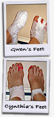 Photos of bandaged feet